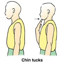 chin tuck 3
